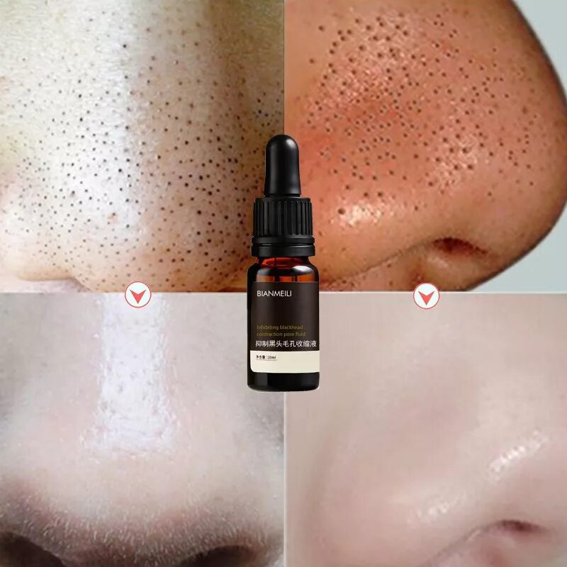 Средство от расширенных пор на лице. Суживающий поры. Суживающий поры. Суживающий поры. Суживающий поры.