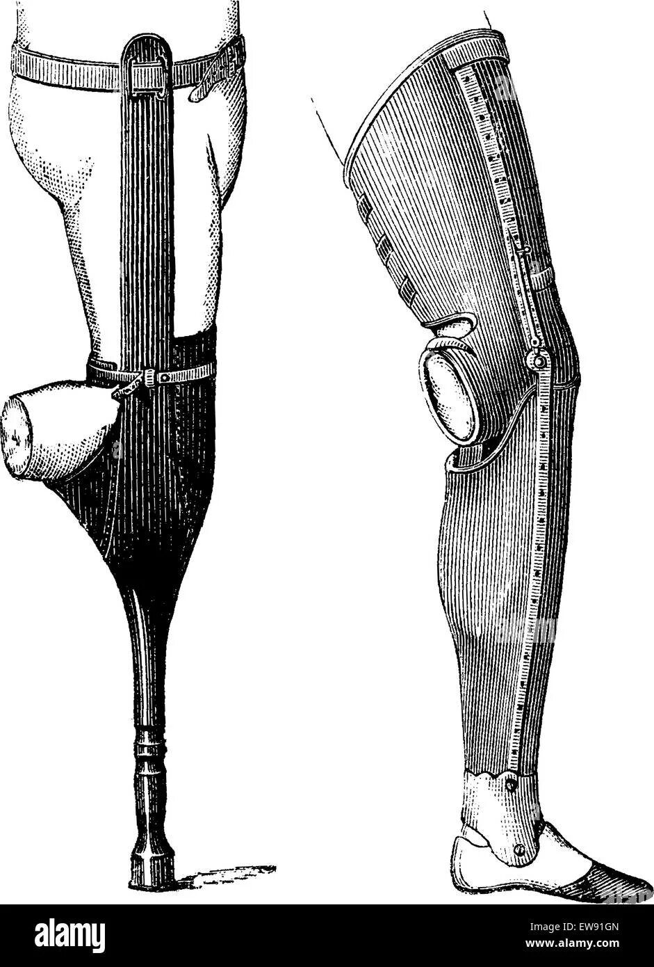 Костыли ампутация. Протез голени. Протез ноги. Ампутация голени протез.