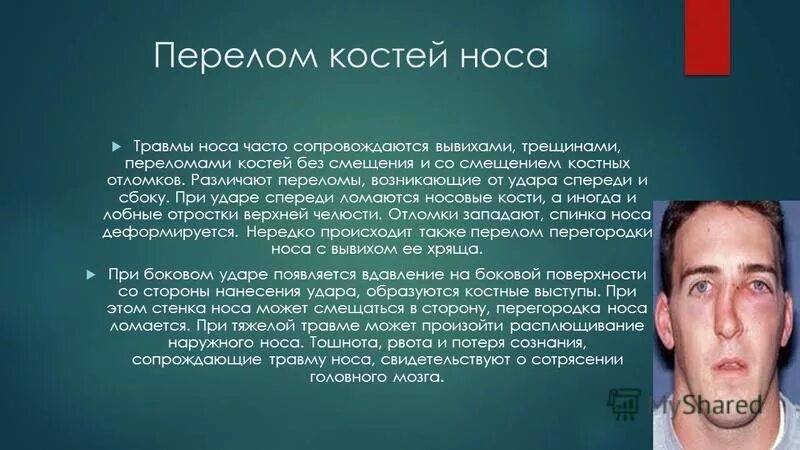 Перелом костей носа локальный статус. Симптомы перелома кости носа. Перелом костей носа статус локалис.