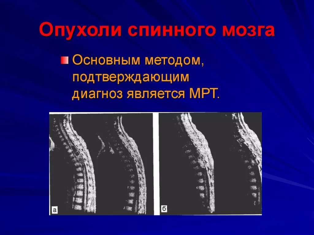 Позвоночник припухлость