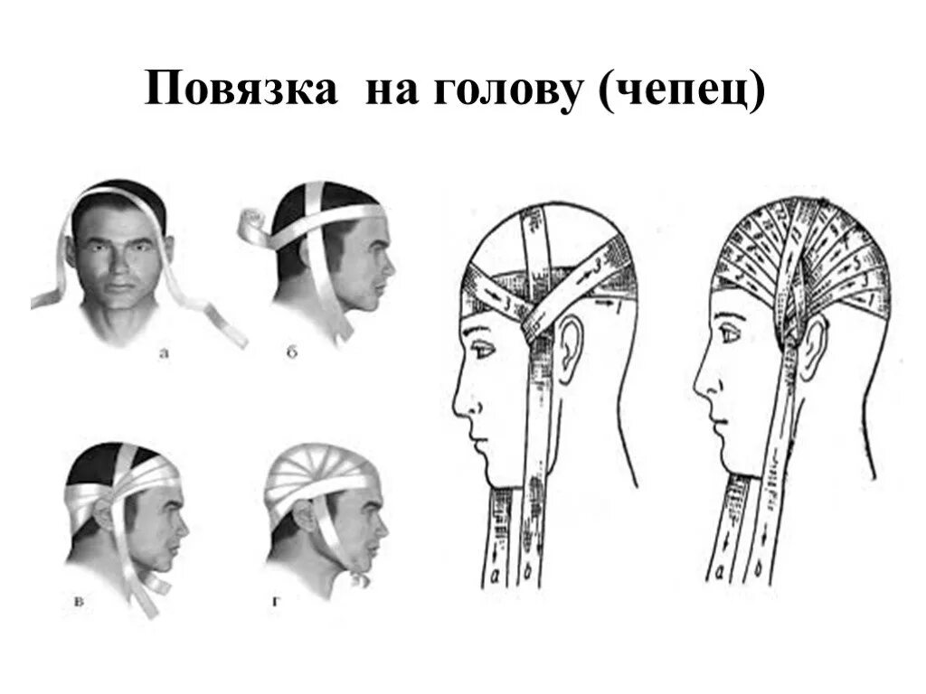 Алгоритм чепца