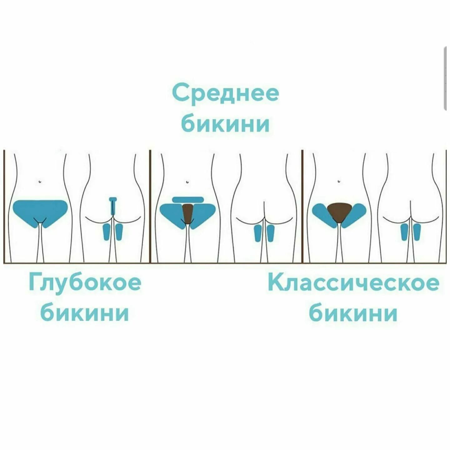 Бикини что находится в тихом. Зона классического бикини. классическое бикини. шугаринг бикини классика. классическое среднее и глубокое бикини.