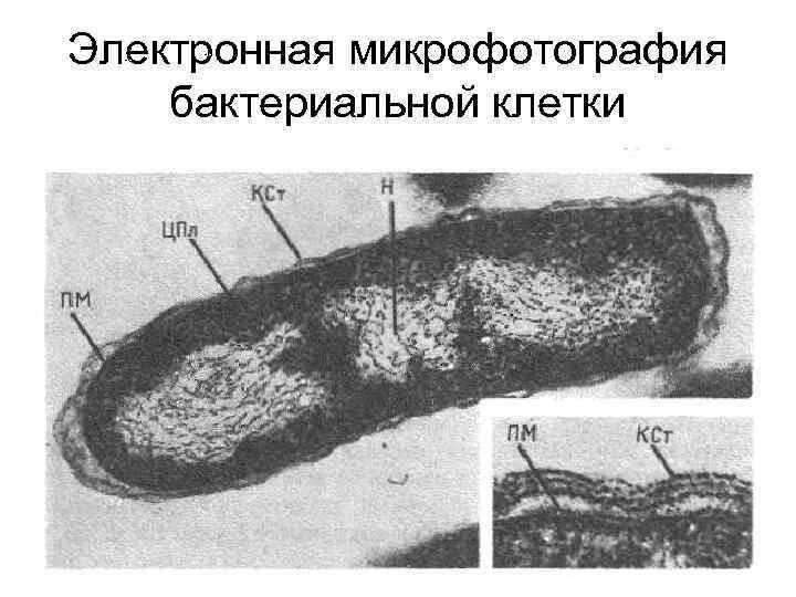 На электронной микрофотографии изображена структура