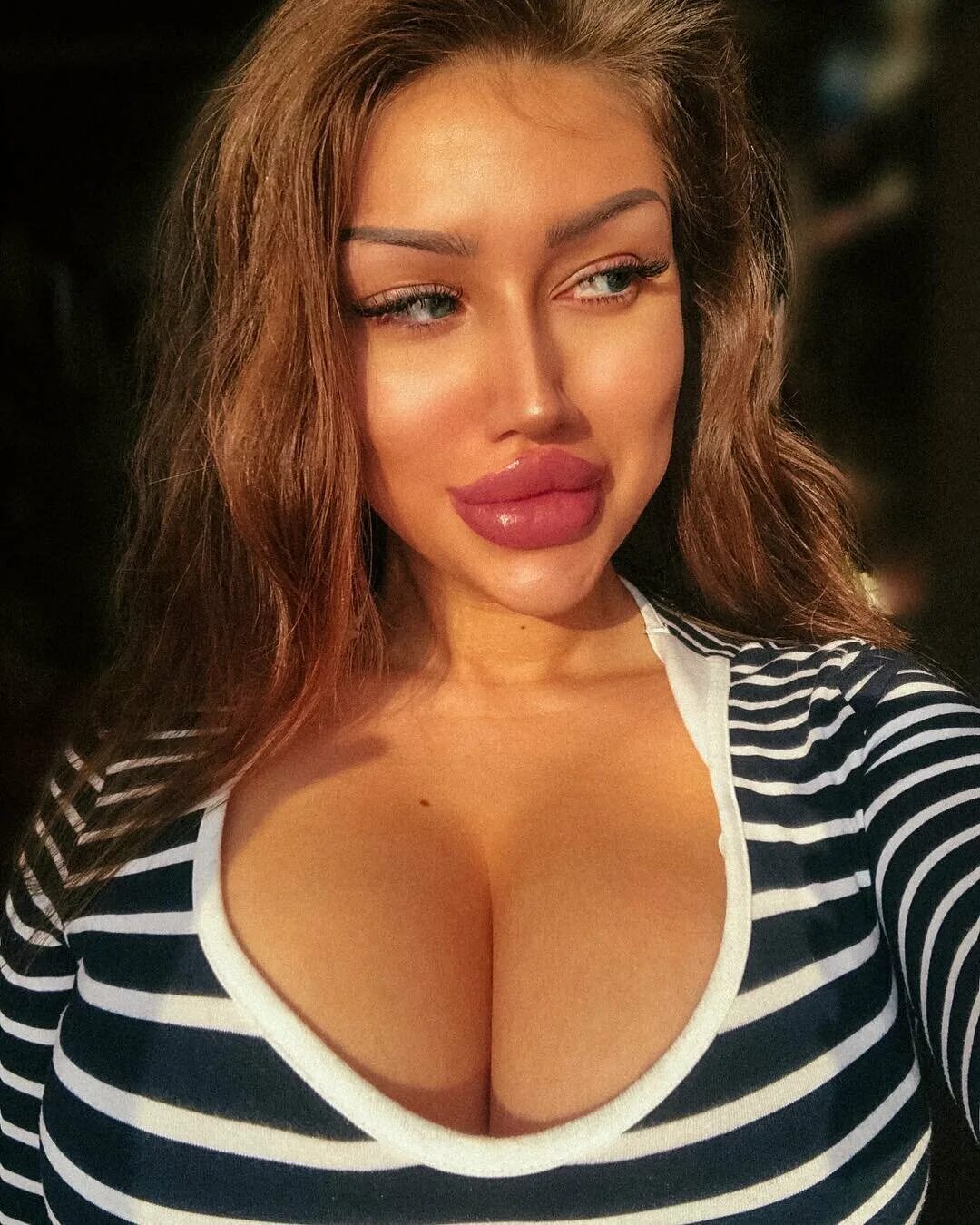 Силикон в губы. Силикон в губы. Сэмми льюис. Силикон в губы. Силиконовые губы.