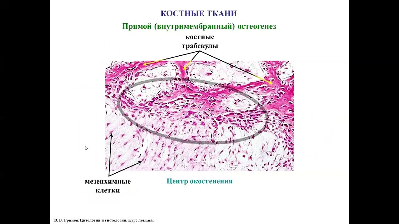 Прямой и непрямой остеогенез гистология. Костная ткань гистология препарат. препарат непрямого остеогенеза гистология. непрямой остеогенез гистология препарат.