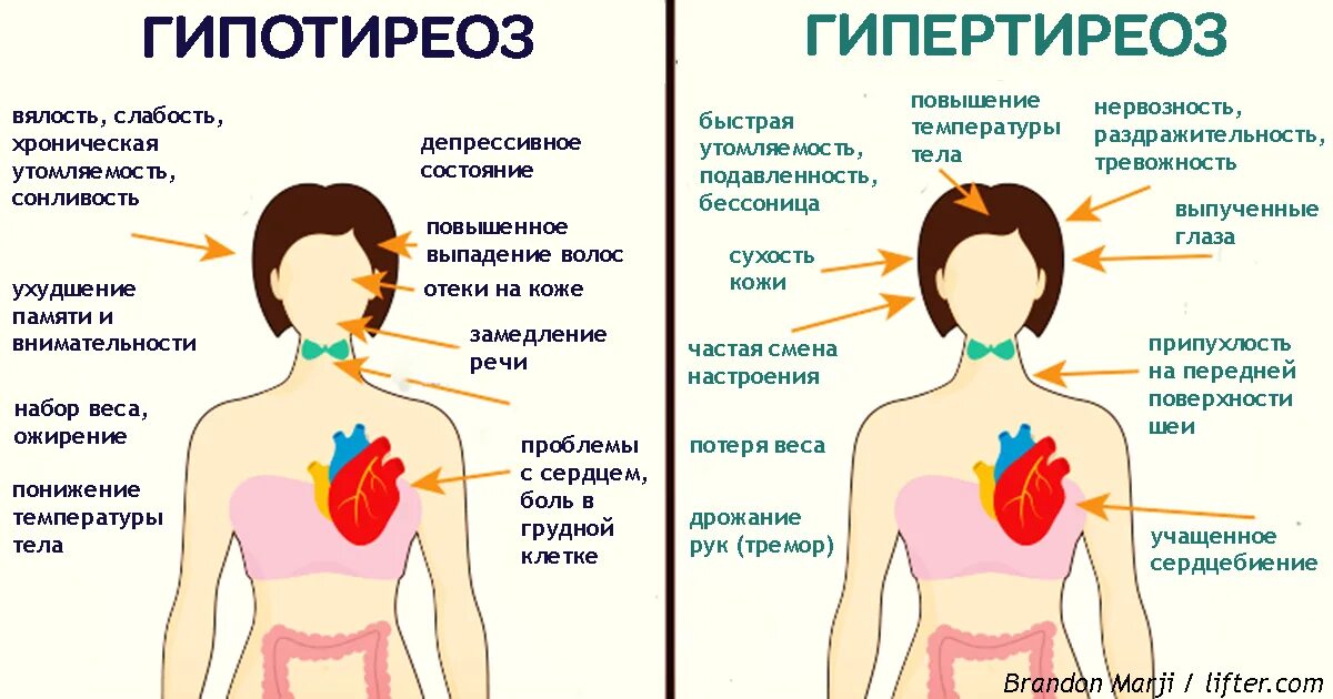 Что может быть из. Гипотиреоз и гипертиреоз симптомы. Гипо гипертиреоз щитовидной железы. Симптомы гипотермозс и гипертериоза. Профилактика гипотиреоза у женщин.