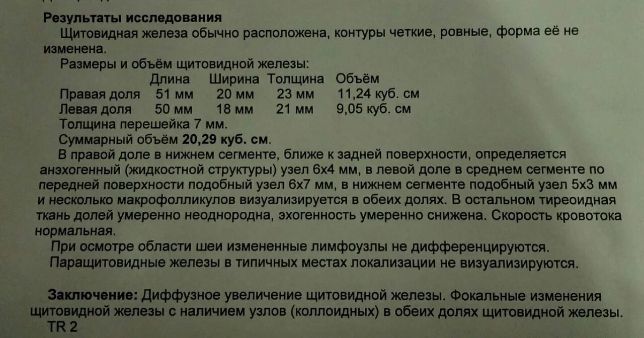 Размеры щитовидки у женщин. Нормы долей щитовидной железы у женщин по УЗИ. Нормальные показатели УЗИ щитовидной железы у женщин. Норма объема щитовидной железы у женщин по УЗИ.