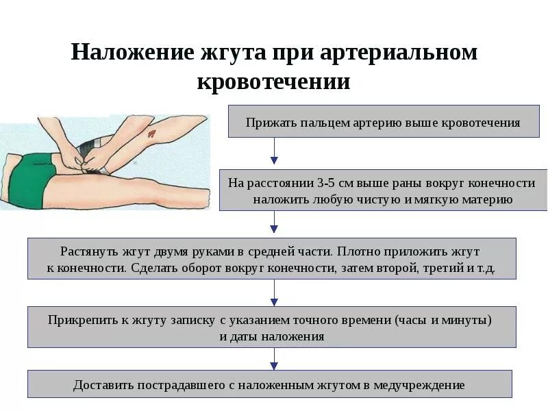 Этапы оказания первой помощи при артериальном кровотечении. Артериальное кровотечение алгоритм оказания первой помощи. Алгоритм 1 помощи при артериальном кровотечении. Алгоритм оказания ПМП при артериальном кровотечении. При каком виде кровотечения необходимо наложить жгут