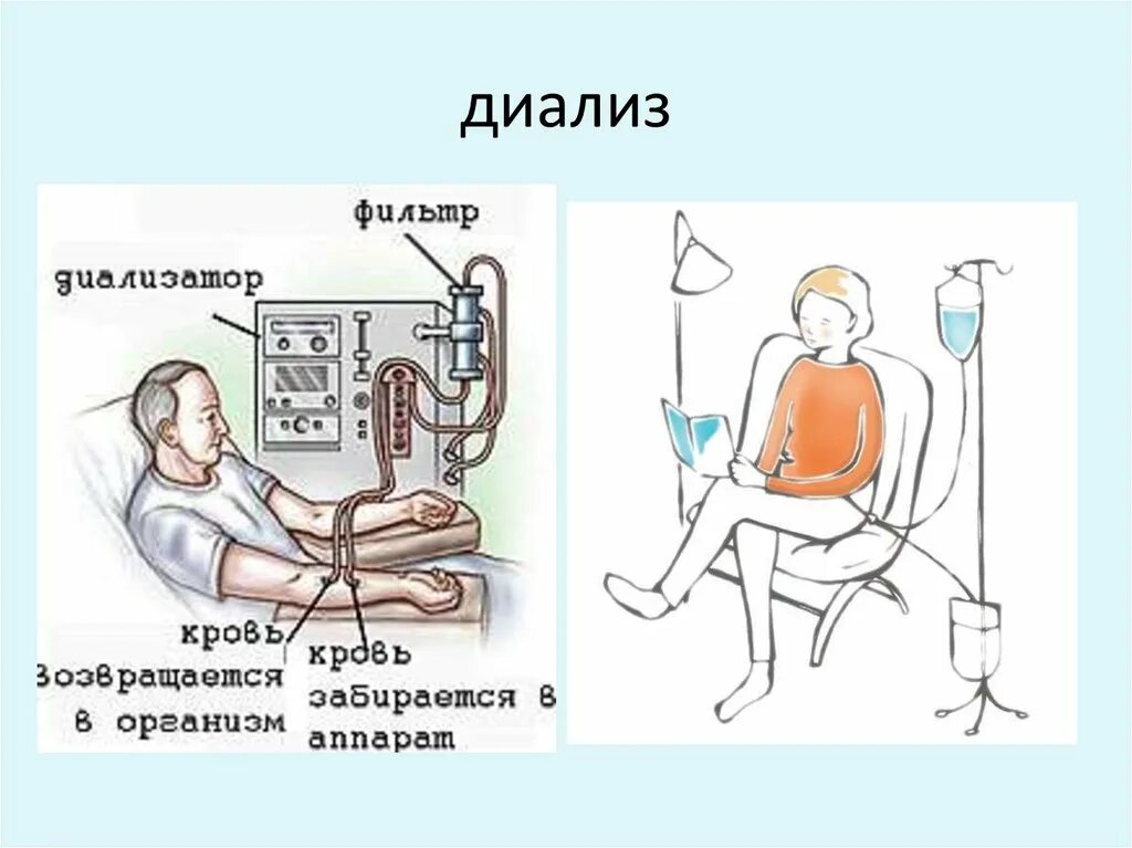 Диализ белков. Компенсационный диализ. Схема компенсационного диализа. Компенсационный диализ и вивидиализ.