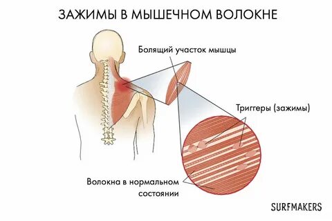 Зажатые мышцы
