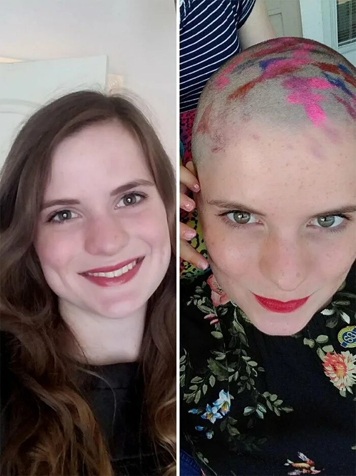 Волосы после химиотерапии. Волосы до и после химиотерапии. Отросшие волосы после химиотерапии. Эксперименты с волосами. Волосы после онкологии