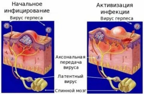 Причины возникновения герпеса на половых органах
