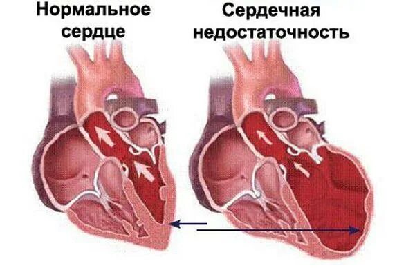 Сердечная недостаточность как выглядит у собаки Почечная недостаточность у собак: симптомы и лечение