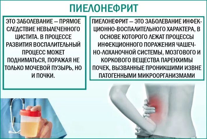 Гематурия цвет мясных помоев. Сбор мочи. Нормальный цвет мочи в баночке. Старая моча. Старая моча.