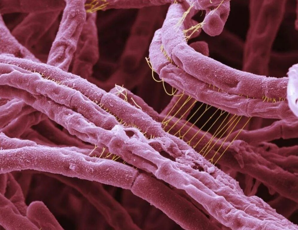 Bacillus anthracis. Bacillus anthracis, а22 (Сибирская язва).