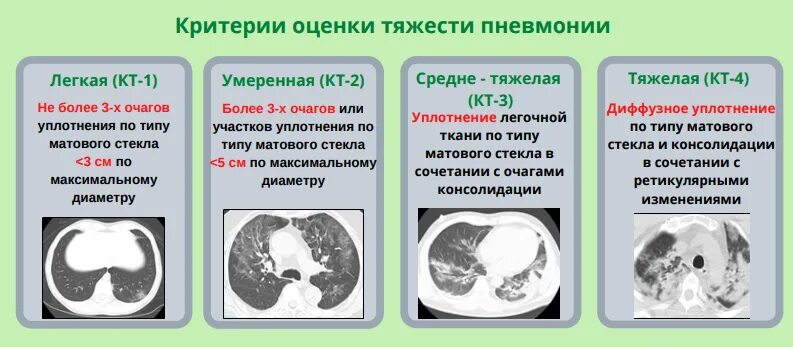 Кт 4 легкие. Поражение легких при кт коронавирус. Кт лёгких. Степени поражения легких. Кт степени поражения легких.