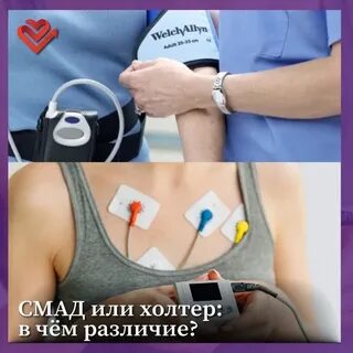 Смад и холтер
