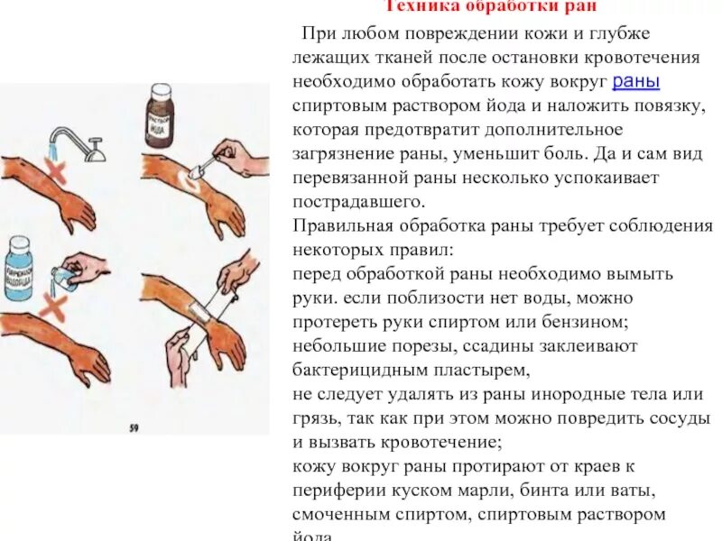 Чем обрабатывать кожу после. Обработка краев раны йодом. Обработка РАН И наложение повязок. Алгоритм обработка раны наложение повязки.