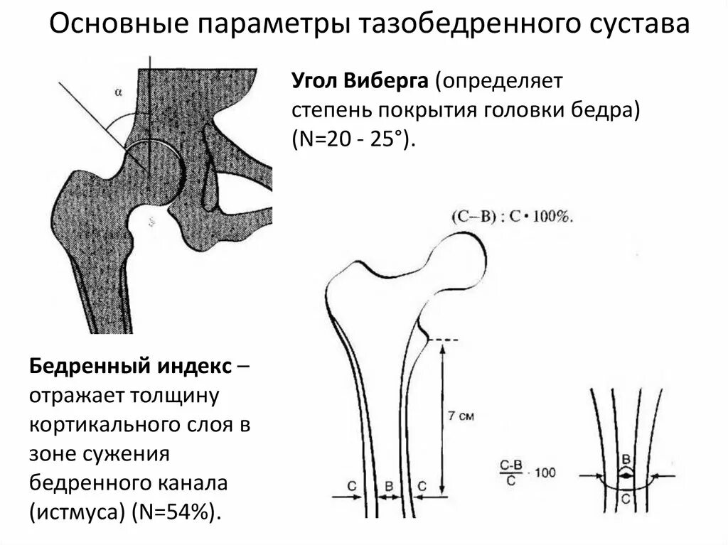 Тазобедренные суставы тип 2а