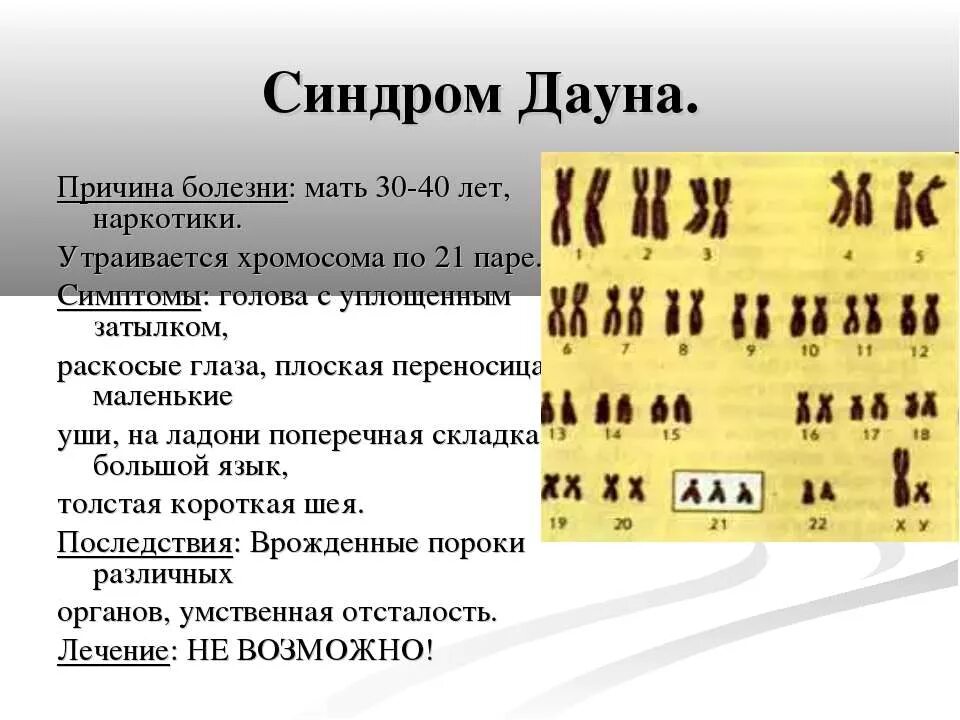 генетика и здоровье человека 10 класс. синдром дауна причины возникновения. болезнь дауна хромосомный набор. синдром дауна последствия. синдром дауна хромосомная болезнь.
