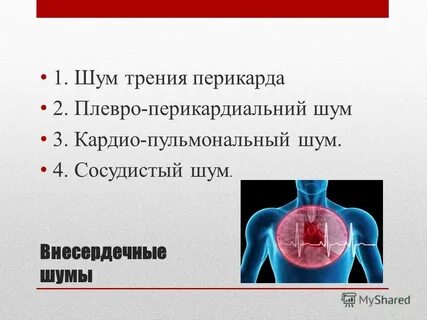 Сосуды шум