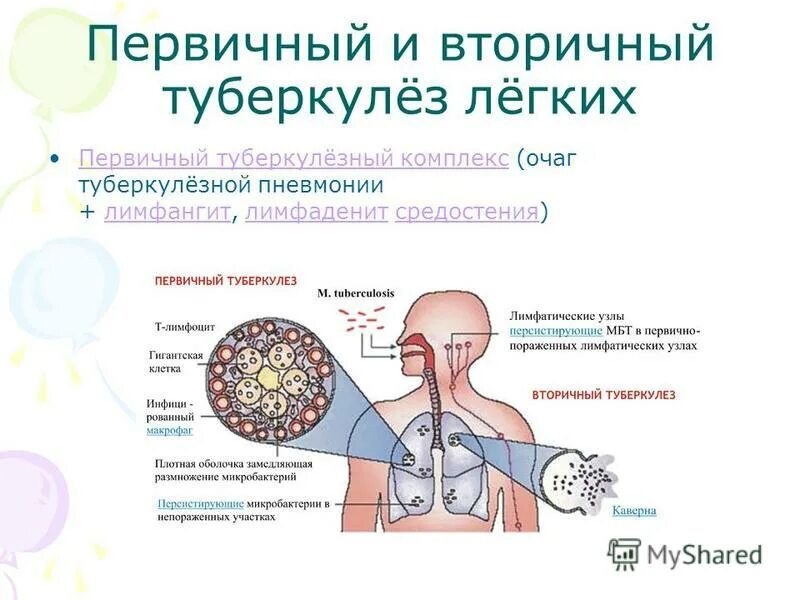 Туберкулез челябинск. Различия первичного и вторичного туберкулеза. Первичный и вторичный туберкулез отличия. Туберкулез первичный первичный и вторичный.