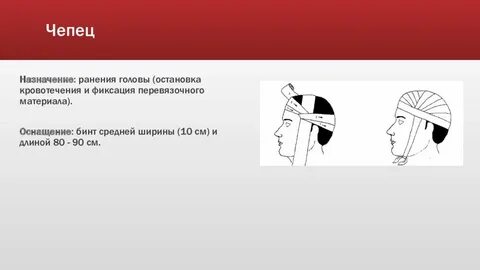 Повязка чепец алгоритм наложения