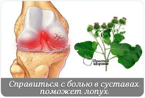 Лечение лопухом артроза коленного сустава