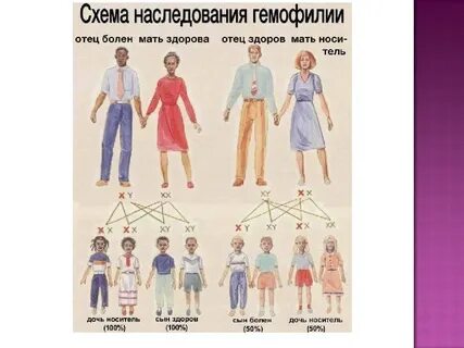 Гемофилия схема