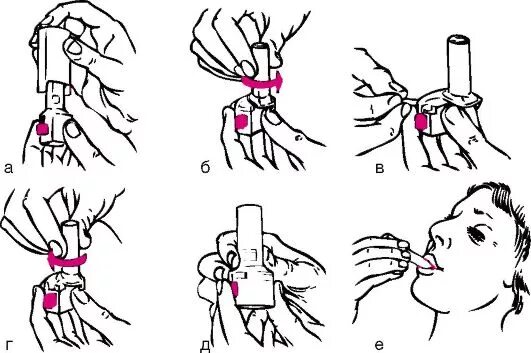 Пользование ингалятором алгоритм. Применение ингалятора алгоритм. Правила пользования карманным ингалятором. Применение карманного ингалятора алгоритм. Карманный дозированный ингалятор алгоритм.