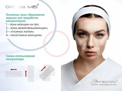 Мезотерапия для лица мезороллером отзывы