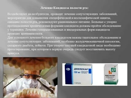 Кандидоз ротовой полости лечение
