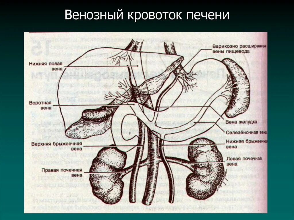 Кровообращение воротной вены. Воротная Вена печени анатомия. Селезеночная артерия анатомия. Кровоснабжение печени анатомия схема. Печеночная артерия и воротная Вена.