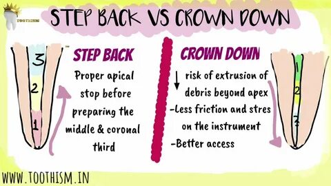 Step back