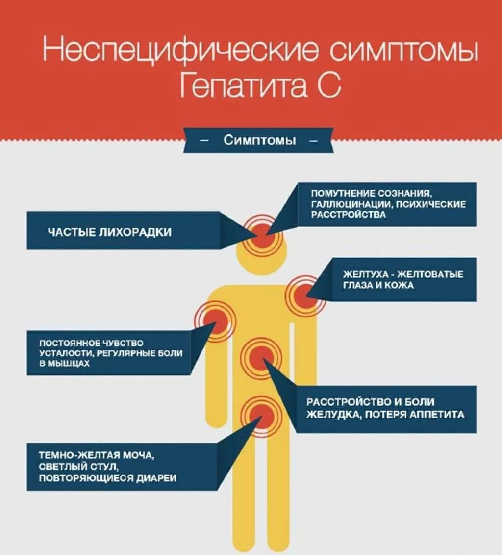 Симптомы гепатита а у взрослых. Первые симптомы гепатита. Вирусный гепатит симптомы.