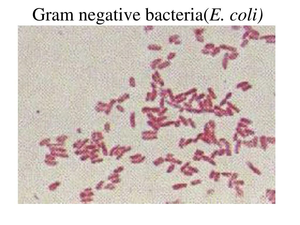 Haemophilus в мазке у мужчин. Гемофильная палочка микробиология. Гемофильная палочка микроскопия. Бактерии Haemophilus influenzae. Бордетеллы коклюша микроскопия.