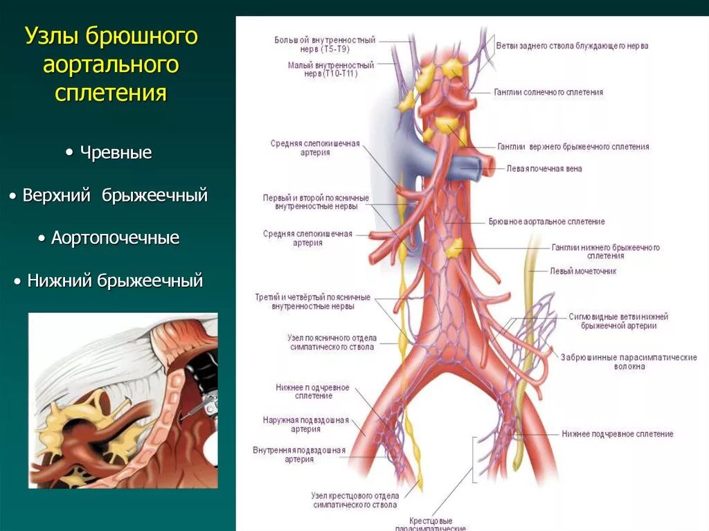 Узлы чревного сплетения. Чревные узлы анатомия. Вегетативные сплетения брюшной полости. Топография чревного сплетения.