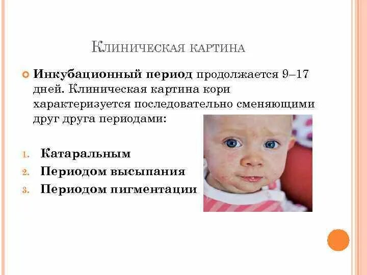 Корь инкубационный период. Корь клиническая картина. периоды заболевания кори. корь у детей клиническая картина. клинические проявления в катаральный период кори.
