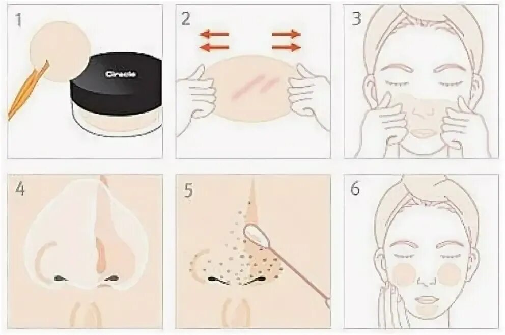 Manyo blackhead