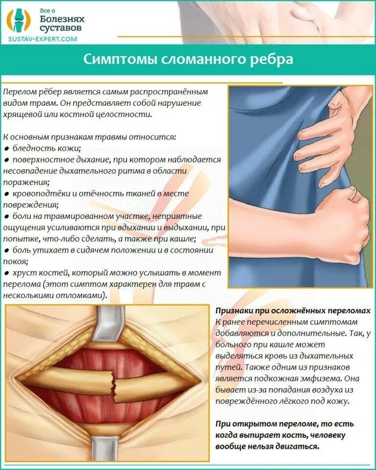 Симптомы сломанных. Симптомы сломанных. Абсолютные признаки перелома. Абсолютные симптомы перелома кости. Признаки перелома позвоночника.