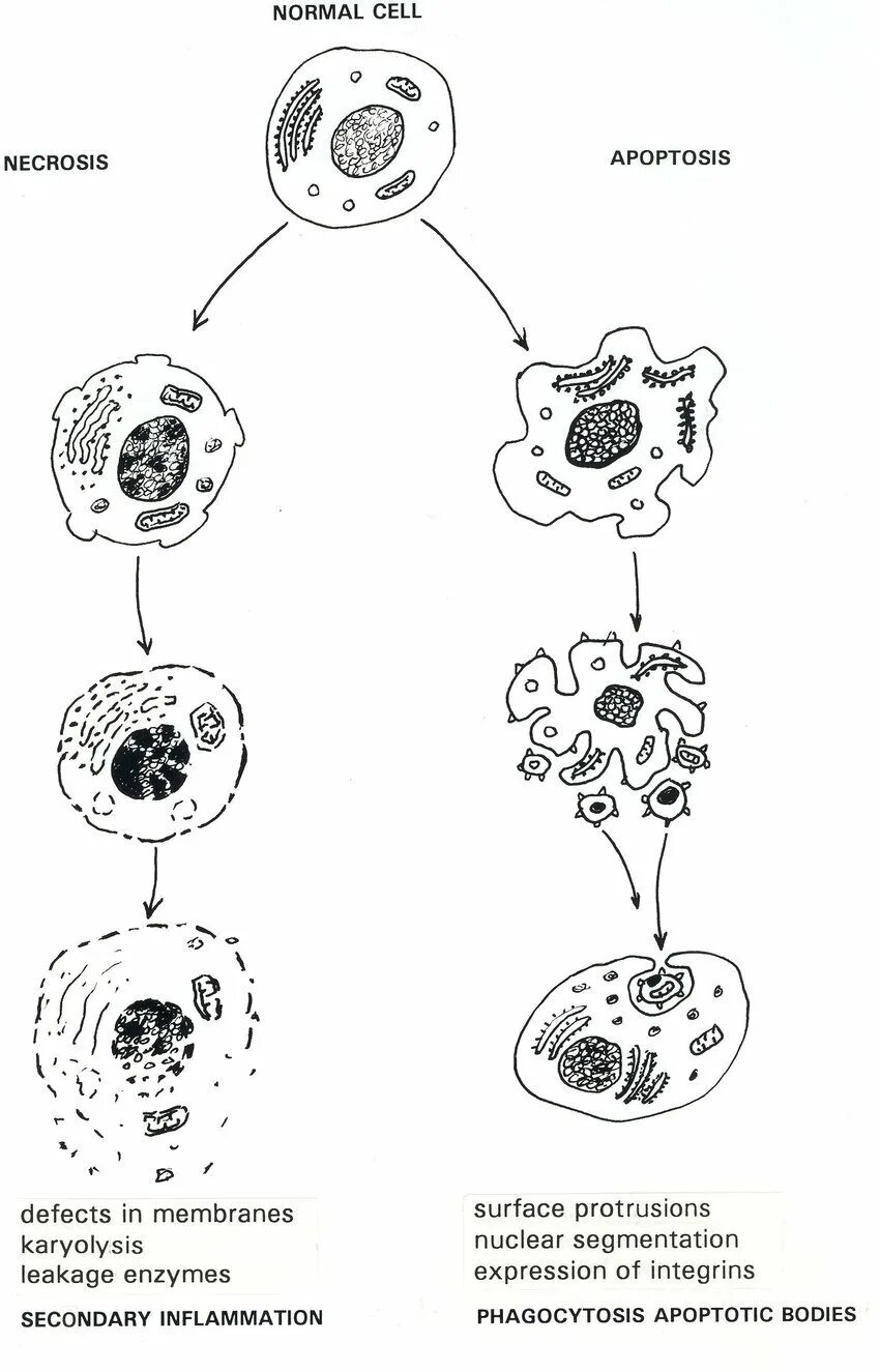 Кариопикноз это. Изменение клетки при некрозе и апоптозе схема. Апоптоз клетки схема. Изменение клетки при некрозе схема. Некроз клетки схема.