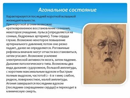 Предсмертное состояние человека