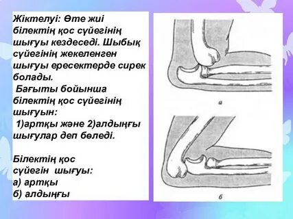 Білектің фотосы