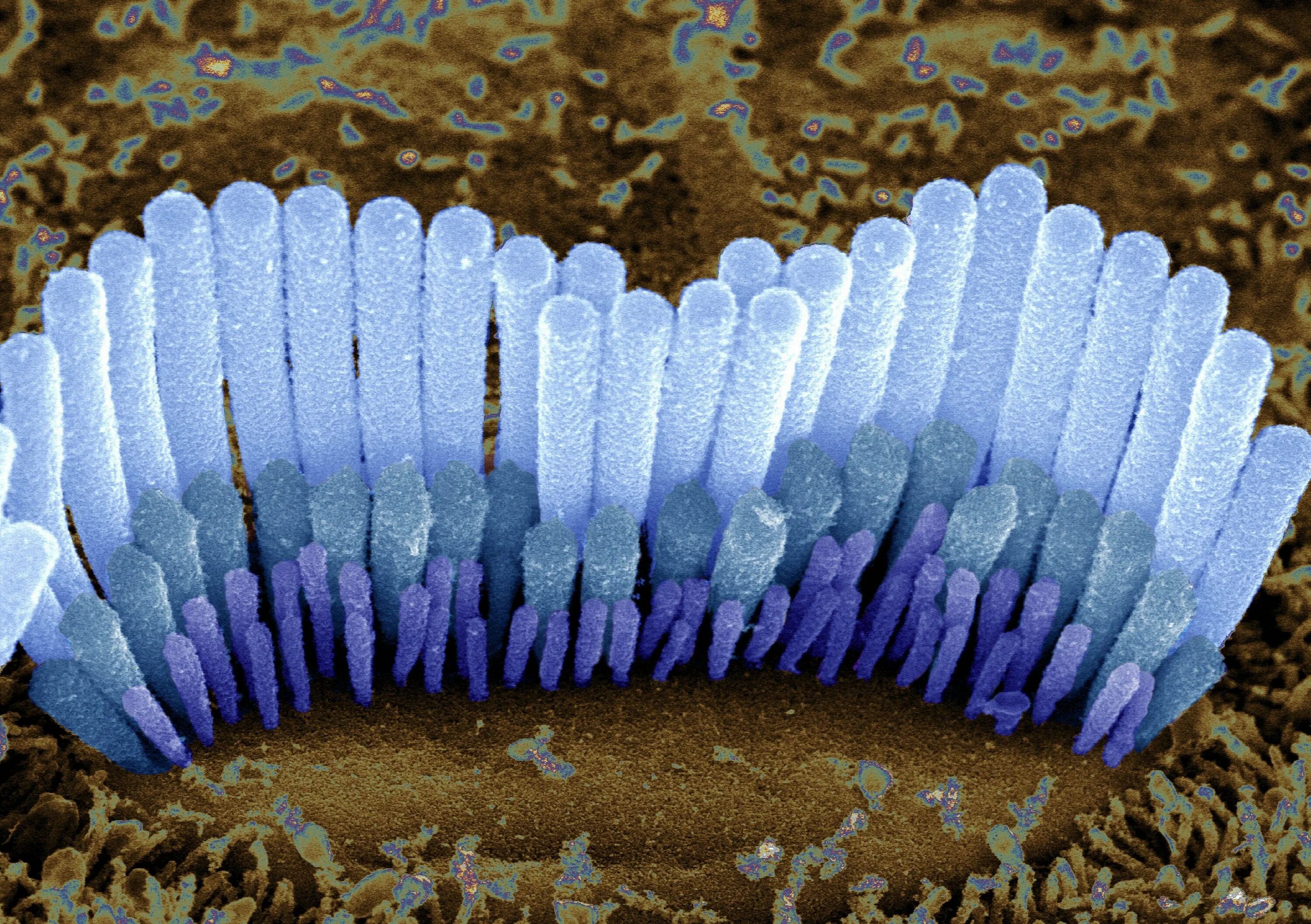 Клетки волосков улитки. Волосковые клетки внутреннего уха. Волосковые клетки уха микроскоп. Волосковые клетки улитки внутреннего уха. Волосковые реснитчатые клетки внутреннего уха.