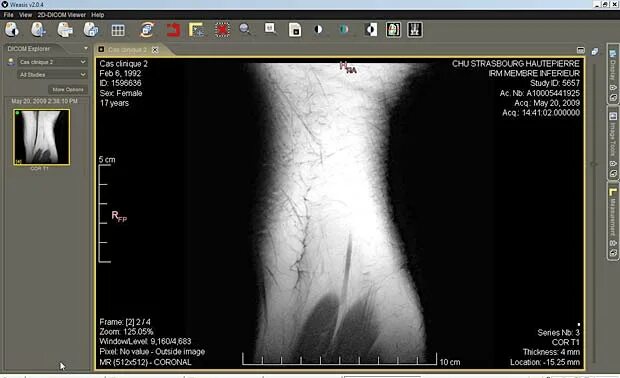 Dcm4chee. Weasis Dicom viewer. Dicom Формат. DCM Dicom. 4 che