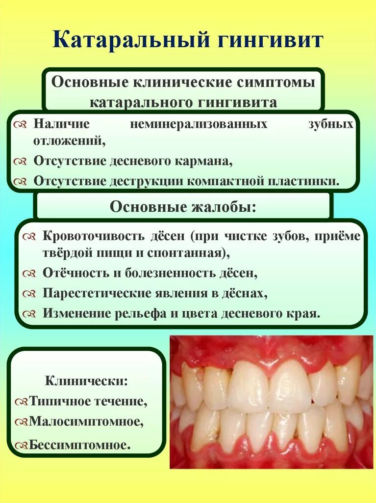 Кровоточат десны витамины. Острый каратальный гингигивит. Катаральное воспаление десен.