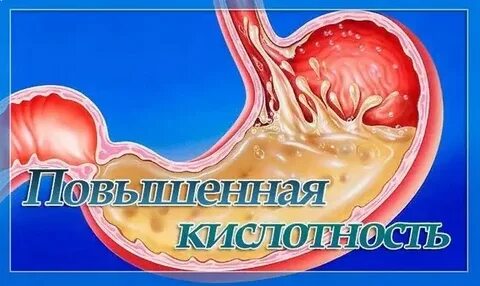 Повышенная кислотность желудка симптомы и лечение