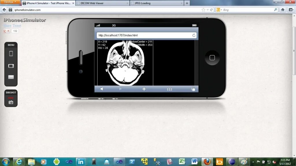 Web view. Dwv (dicom web viewer). webviewer. буквы ff айфон. web view 2.
