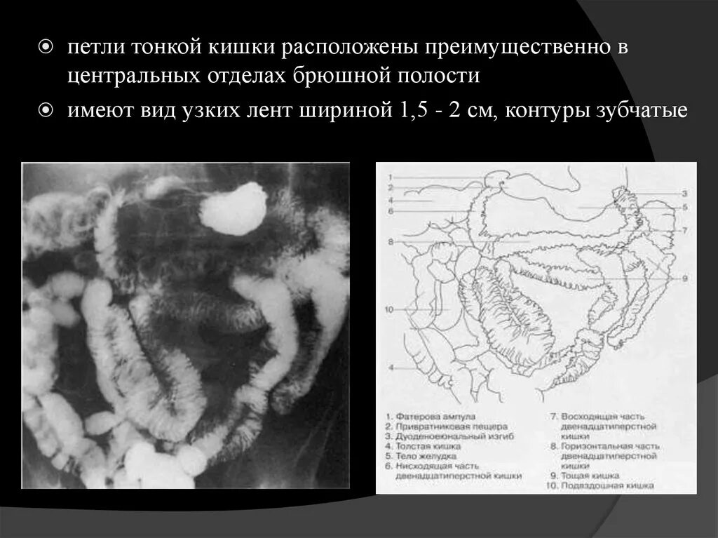 Подвздошная кишка. Петли подвздошной кишки располагаются:. Петли подвздошной кишки расположены.