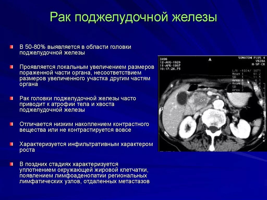 Фиброзные изменения поджелудочной